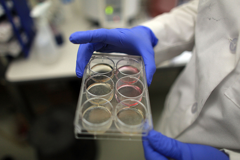 Professor of Genetics and Developmental Biology Stormy Chamberlain holds a tray of stem cells 