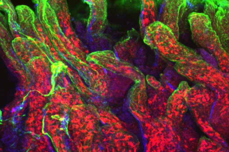 Research by Leo Lefrancois. Visualization of specialized antigen presenting cells in the small intestine.
